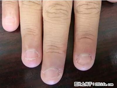 剪指甲、挖耳屎，这些日常小动作竟隐藏大危害！ - 内江生活资讯 - 内江28生活网 scnj.28life.com